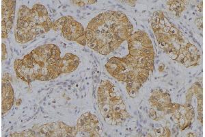 ABIN6273634 at 1/100 staining Human uterus tissue by IHC-P. (HSP77/76 antibody)