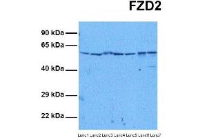 Host:  Rabbit  Target Name:  FZD2  Sample Tissue:  Human HepG2, Human Jurkat, Human MCF7, Human DLD1, Human Hela, Human Fetal Liver, Human Stomach Tumor  Antibody Dilution:  1. (FZD2 antibody  (N-Term))