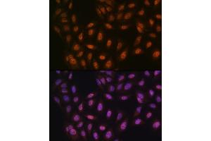 Immunofluorescence (IF) image for anti-Protein Arginine Methyltransferase 1 (PRMT1) antibody (ABIN7269604)