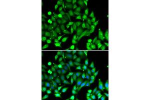 Immunofluorescence analysis of U20S cell using STAT4 antibody. (STAT4 antibody)