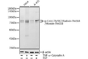 Western blot analysis of extracts of various cell lines, using Phospho-Ezrin-Thr567/Radixin-Thr564/Moesin-Thr558 antibody (ABIN7267076) at 1:1000 dilution. (EZR/RDX/MSN (pThr558), (pThr564), (pThr567) antibody)