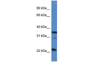 WB Suggested Anti-SFRS2 AntibodyTitration: 1. (SRSF2 antibody  (C-Term))