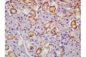 Formalin-fixed and paraffin embedded rat lymph node labeled with Rabbit Anti-Axin 2 Polyclonal Antibody, Unconjugated  at 1:200 followed by conjugation to the secondary antibody and DAB staining (AXIN2 antibody  (AA 331-430))