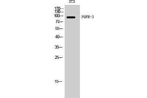 Western Blotting (WB) image for anti-Fibroblast Growth Factor Receptor 3 (FGFR3) (Internal Region) antibody (ABIN3184616)
