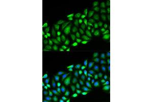 Immunofluorescence analysis of HeLa cell using RIPK2 antibody. (RIPK2 antibody  (AA 1-540))