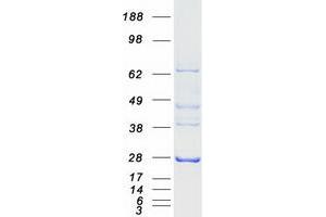 Validation with Western Blot (AK4 Protein (Transcript Variant 6) (Myc-DYKDDDDK Tag))