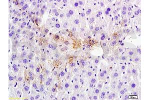 Formalin-fixed and paraffin embedded rat liver tissue labeled with Anti-Tsg101 Polyclonal Antibody (ABIN685507), Unconjugated at 1:200 followed by conjugation to the secondary antibody, (SP-0023), and DAB staining (TSG101 antibody  (AA 4-120))