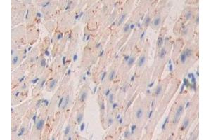 Detection of NEXN in Mouse Heart Tissue using Polyclonal Antibody to Nexilin (NEXN)