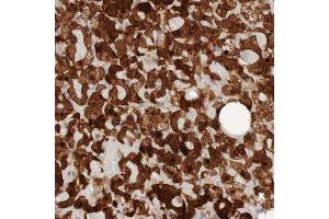 Immunohistochemical staining (Formalin-fixed paraffin-embedded sections) of human adrenal gland with PARP4 polyclonal antibody  shows strong nuclear and cytoplasmic positivity in cortical cells. (PARP4 antibody  (AA 247-392))