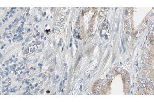 ABIN6272944 at 1/100 staining Human prostate tissue by IHC-P. (HMGCS1 antibody  (Internal Region))