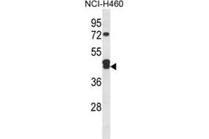 Western Blotting (WB) image for anti-Isocitrate Dehydrogenase 3 (NAD+) gamma (IDH3G) antibody (ABIN3004326)