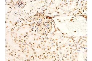 ABIN6267301 at 1/100 staining mouse kidney tissue sections by IHC-P. (EIF2S1 antibody  (pSer51))