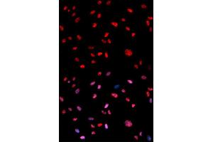 Immunofluorescence analysis of U2OS cells using Phospho-Jun-T239 antibody (ABIN5969906). (C-JUN antibody  (pThr239))