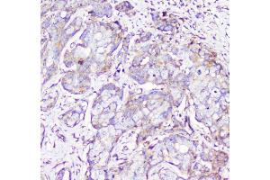 IHC analysis of RP2 using anti-RP2 antibody (ABIN6719513). (RP2 antibody  (AA 244-348))
