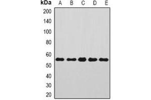 Western blot analysis of Annexin A11 expression in Jurkat (A), SKOV3 (B), A549 (C), mouse kidney (D), rat brain (E) whole cell lysates. (Annexin A11 antibody)