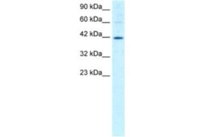 Western Blotting (WB) image for anti-Mesoderm Induction Early Response 1 (MIER1) antibody (ABIN2460961)