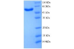 MICAL2 Protein (AA 1-495, partial) (His tag)