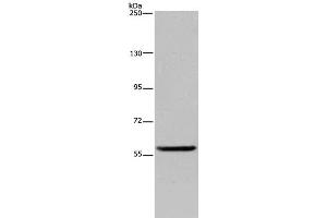Western Blot analysis of Human fetal brain tissue using LBR Polyclonal Antibody at dilution of 1:300 (Lamin B Receptor antibody)