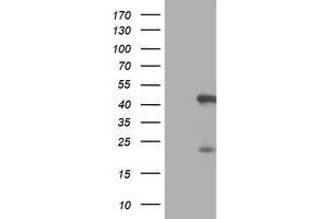 HEK293T cells were transfected with the pCMV6-ENTRY control (Left lane) or pCMV6-ENTRY SERPINB6 (Right lane) cDNA for 48 hrs and lysed. (SERPINB6 antibody)