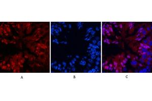 Immunofluorescence analysis of mouse testis tissue. (NF-kB p65 antibody  (acLys310))