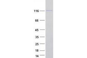 Validation with Western Blot (HNRNPU Protein (Transcript Variant 2) (Myc-DYKDDDDK Tag))