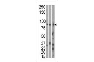 The anti-RK1 C-term Pab 7144b is used in Western blot to detect RK1 in, from left to right, Hela, T47D, and mouse brain cell line/ tissue lysate. (MARK1 antibody  (C-Term))