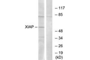 Western blot analysis of extracts from 293 cells, using XIAP (Ab-87) Antibody. (Intestinal Alkaline Phosphatase antibody  (AA 53-102))
