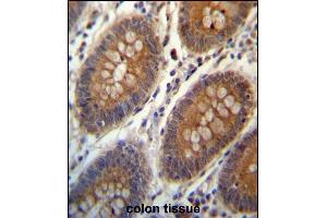 TRIM38 Antibody (C-term) (ABIN657328 and ABIN2846398) immunohistochemistry analysis in formalin fixed and paraffin embedded human colon tissue followed by peroxidase conjugation of the secondary antibody and DAB staining. (TRIM38 antibody  (C-Term))