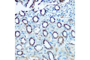 Immunohistochemistry of paraffin-embedded rat kidney using NDUFS4 Rabbit pAb (ABIN6132405, ABIN6144489, ABIN6144491 and ABIN6222016) at dilution of 1:100 (40x lens). (NDUFS4 antibody  (AA 1-175))