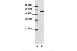Image no. 1 for anti-Coronin, Actin Binding Protein, 1A (CORO1A) (AA 181-230) antibody (ABIN6736110) (Coronin 1a antibody  (AA 181-230))