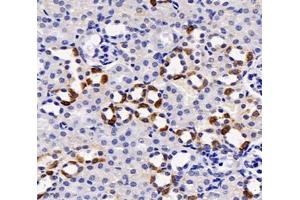 Immunohistochemistry analysis of paraffin-embedded mouse kidney using,NXN (ABIN7074916) at dilution of 1: 2000