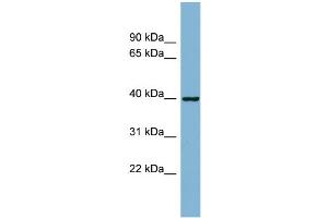 WB Suggested Anti-ELMOD2 Antibody Titration: 0. (ELMOD2 antibody  (N-Term))