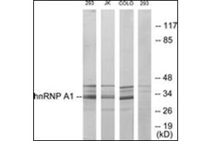Western blot analysis of extracts from 293/Jurkat/COLO205 cells, using hnRNP A1 Antibody. (HNRNPA1 antibody)