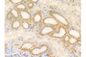 ABIN6256891 and ABIN6274295 at 1/100 staining human normal kidney tissue by IHC-P. (ADK antibody  (N-Term))