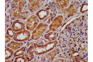 IHC image of ABIN7149571 diluted at 1:200 and staining in paraffin-embedded human kidney tissue performed on a Leica BondTM system. (PDSS2 antibody  (AA 292-387))