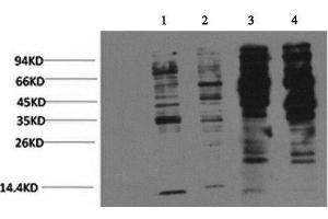 Western Blot analysis of 1) Jurkat, 2) 293T, 3) Rat brain, 4) Mouse brain with Phosphotyrosine Monoclonal Antibody at dilution of 1:2000 (Phosphotyrosine antibody)