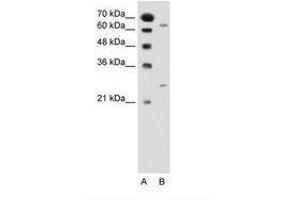 Image no. 1 for anti-N-Acetyltransferase 2 (Arylamine N-Acetyltransferase) (NAT2) (AA 151-200) antibody (ABIN205032) (NAT2 antibody  (AA 151-200))