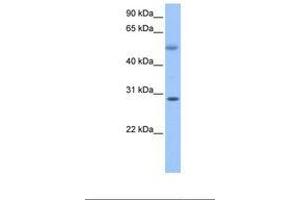 Image no. 1 for anti-Retinoic Acid Induced 12 (RAI12) (C-Term) antibody (ABIN6738920) (Retinoic Acid Induced 12 (RAI12) (C-Term) antibody)