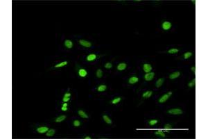Immunofluorescence of purified MaxPab antibody to RPA1 on HeLa cell. (RPA1 antibody  (AA 1-616))