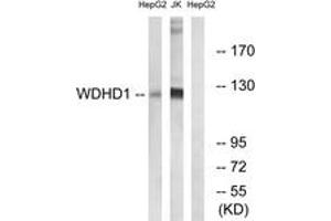 Western blot analysis of extracts from Jurkat/HepG2 cells, using WDHD1 Antibody. (WDHD1 antibody  (AA 721-770))