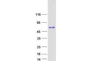 Validation with Western Blot (SP6 Protein (Myc-DYKDDDDK Tag))