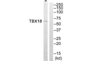 Western Blotting (WB) image for anti-T-Box 18 (TBX18) (Internal Region) antibody (ABIN1852256)