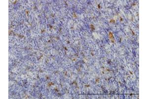 Image no. 1 for anti-Malic Enzyme 1, NADP(+)-Dependent, Cytosolic (ME1) (AA 1-573) antibody (ABIN598801) (ME1 antibody  (AA 1-573))