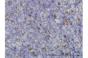Image no. 1 for anti-Malic Enzyme 1, NADP(+)-Dependent, Cytosolic (ME1) (AA 1-573) antibody (ABIN598801)