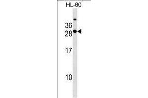 Western blot analysis in HL-60 cell line lysates (35ug/lane). (STXBP6 antibody  (AA 71-97))