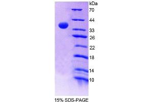 SDS-PAGE analysis of Mouse RNASEH2A Protein. (RNASEH2A Protein)