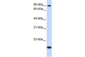 WB Suggested Anti-TSR1 Antibody Titration:  0. (TSR1 antibody  (Middle Region))