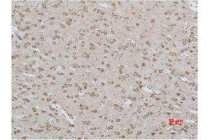 Immunohistochemistry (IHC) analysis of paraffin-embedded Rat Brain Tissue using CACNG3 Polyclonal Antibody. (CACNG3 antibody)