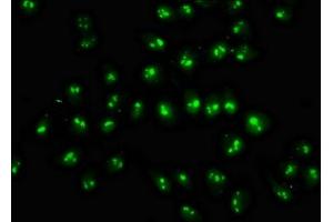 Immunofluorescence staining of Hela cells with ABIN7144976 at 1:333, counter-stained with DAPI. (DDX18 antibody  (AA 32-110))