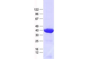 Western Blotting (WB) image for NOP2/Sun Domain Family, Member 3 (NSUN3) protein (His tag) (ABIN2727653)